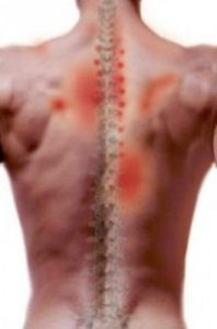 Thoracic Back Pain