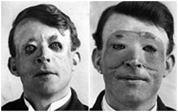 the-evolution-of-plastic-surgery